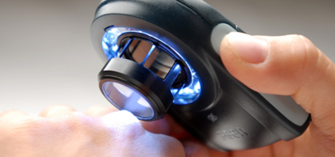 Δερματοσκόπηση στη Καβάλα